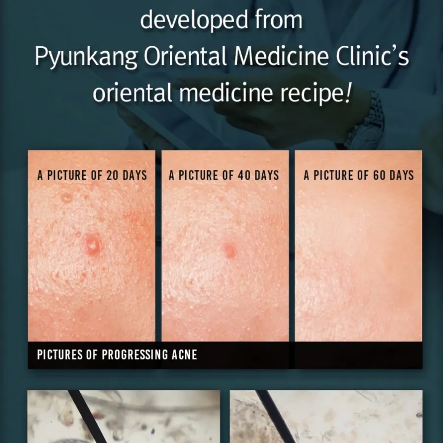 PYUNKANG YUL Acne Facial Cleanser, 120ml/ 4.06fl.oz